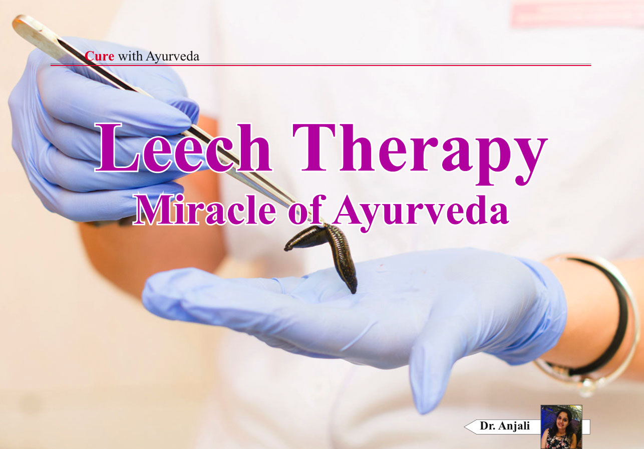 Leech Therapy - Miracle of Ayurveda